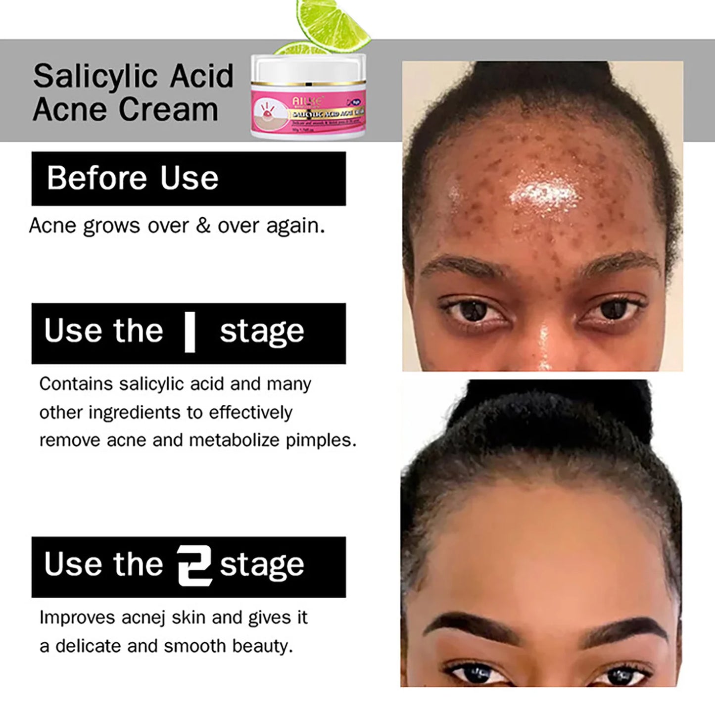 AILKE Daily Rapid Clean Face Cream for Oil Control and Repair - Ky Ky Kiwi
